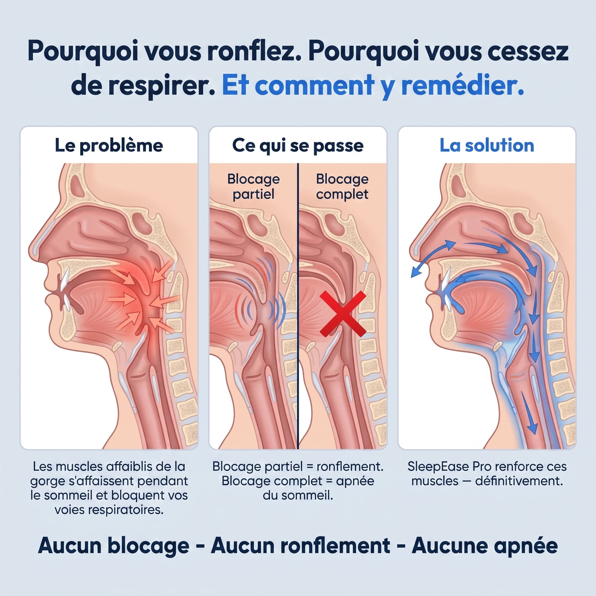 Pourquoi vous ronflez et comment y remedier