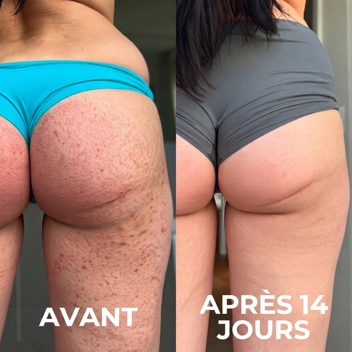 Avant / apres 14 jours
