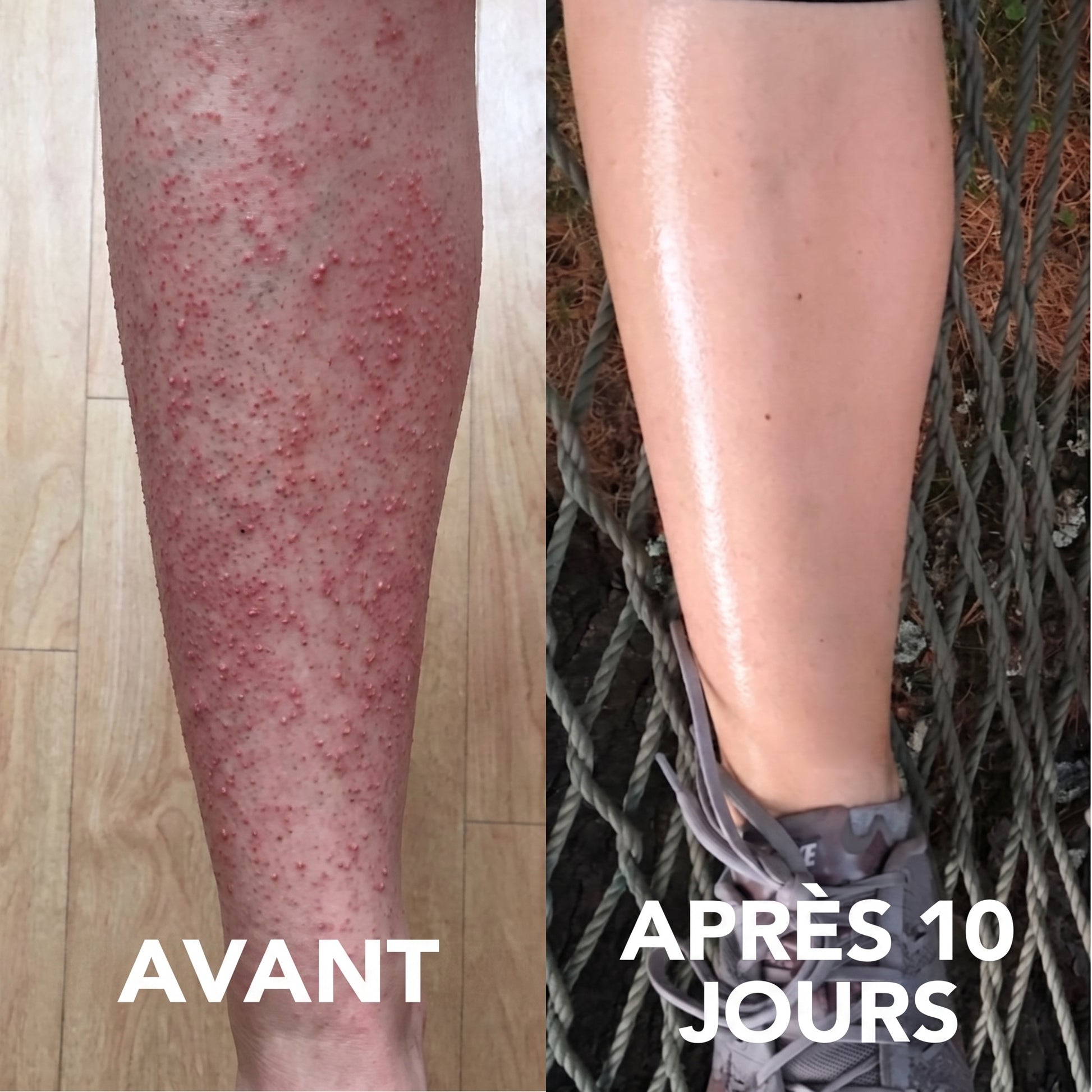 Avant / apres 10 jours