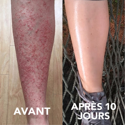 Avant / apres 10 jours