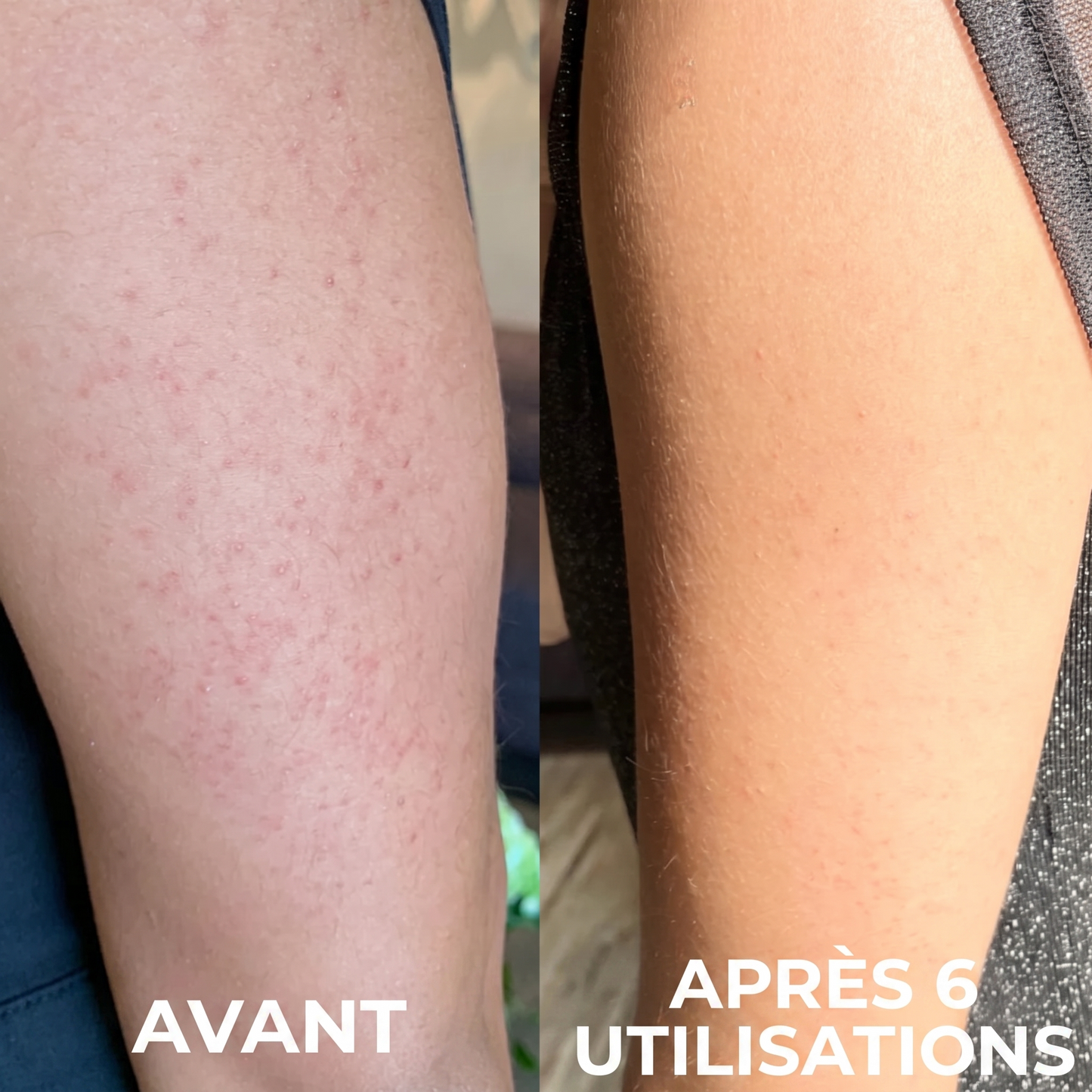 Avant / apres 6 utilisations