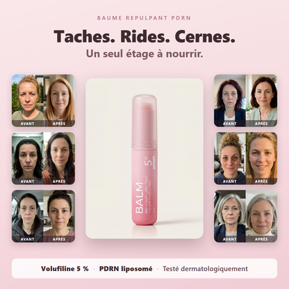 Baume Repulpant PDRN — resultats avant apres et stick