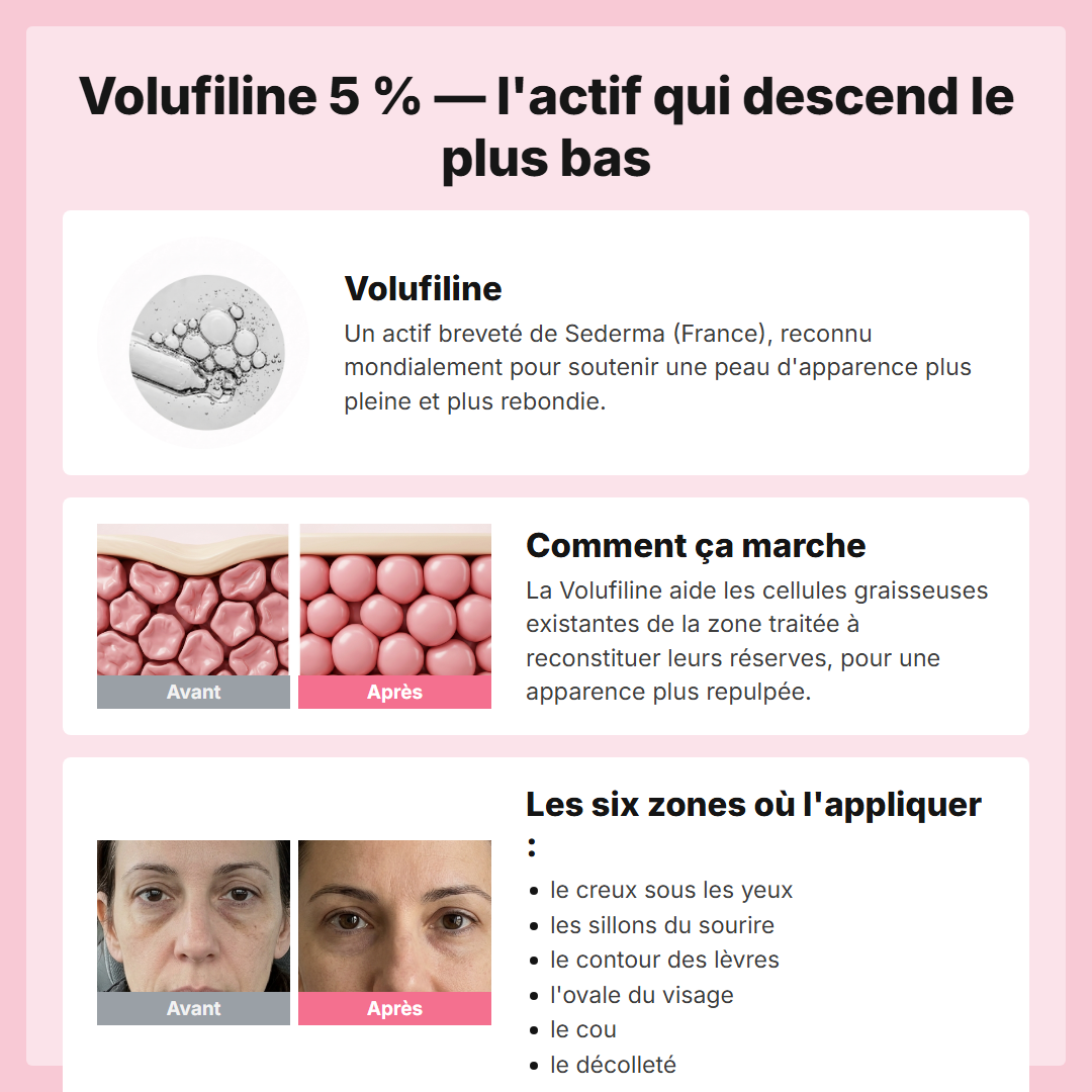 Volufiline 5 pour cent - comment ca marche et les six zones