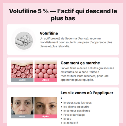 Volufiline 5 pour cent - comment ca marche et les six zones