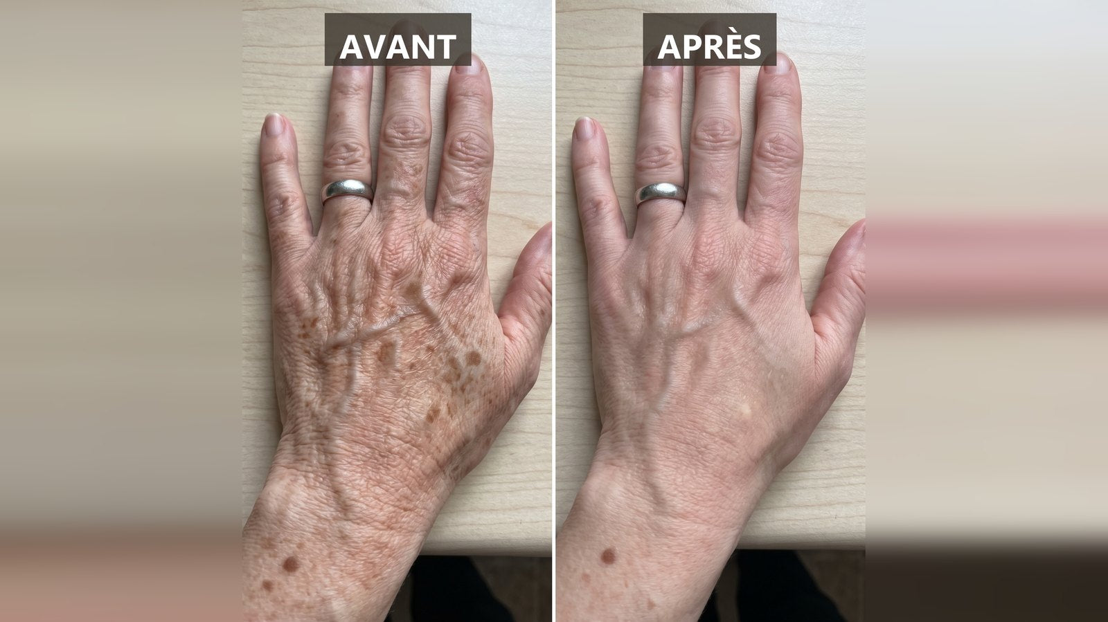 AVANT / APRES MACRO